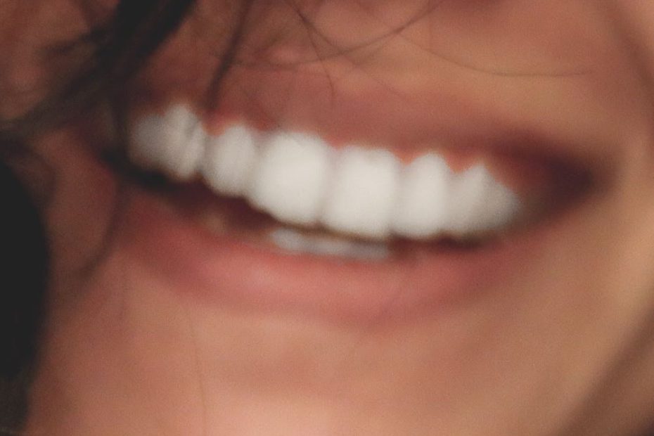 sourire